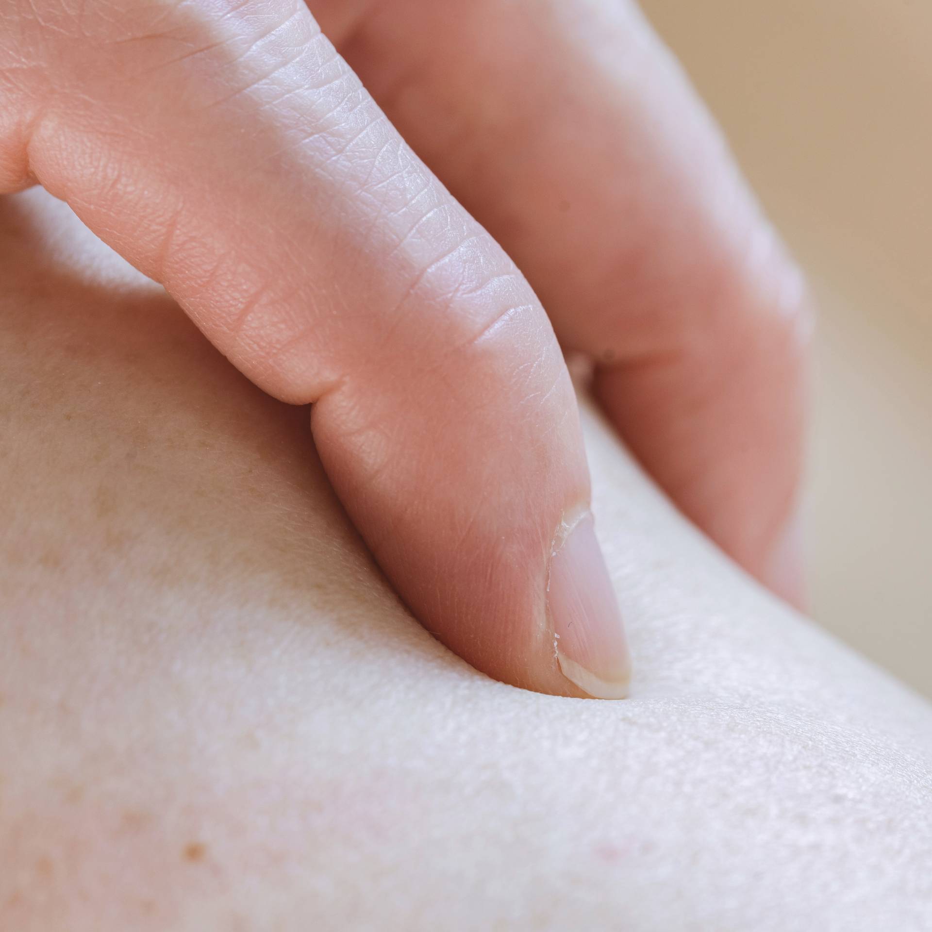 Massaging Hand, Lorraine Pentello, Scar Remediation, Melbourne